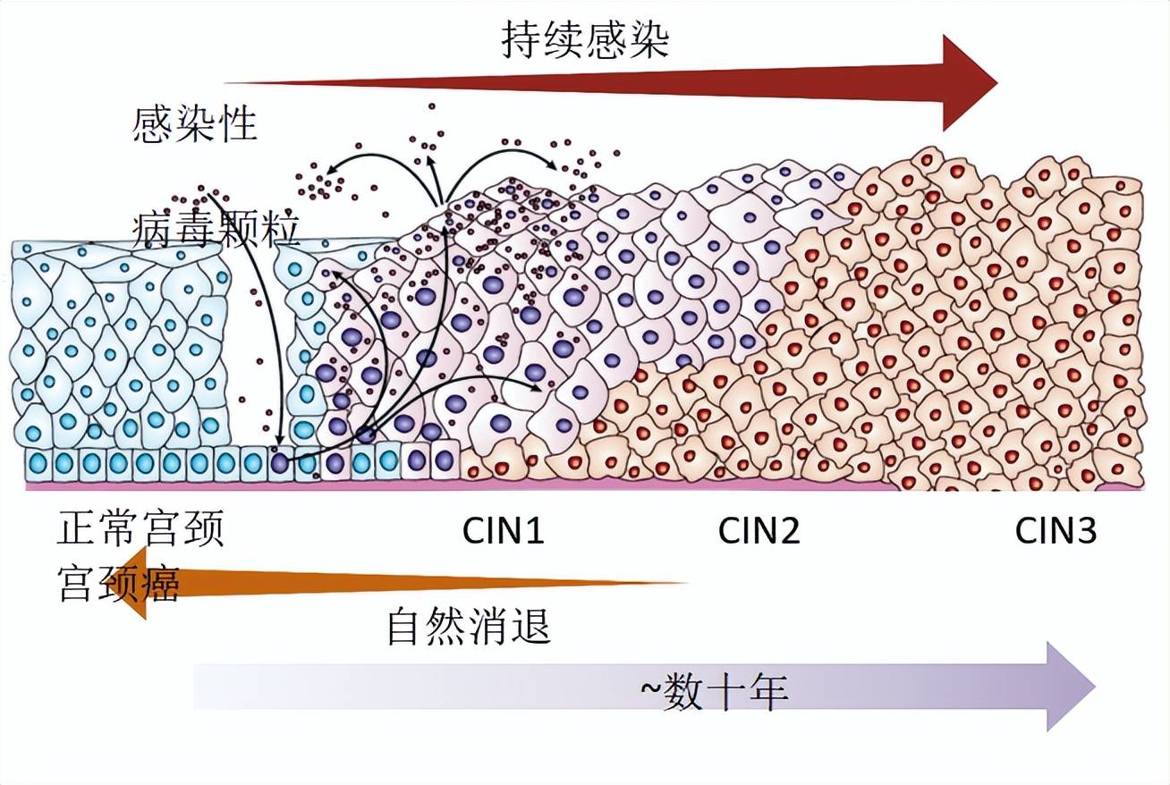 四、PET/CT-MR增强异机融合在宫颈癌诊断中的使用价值|上海大学附属上海全景云医学影像诊断中心|全景医学影像